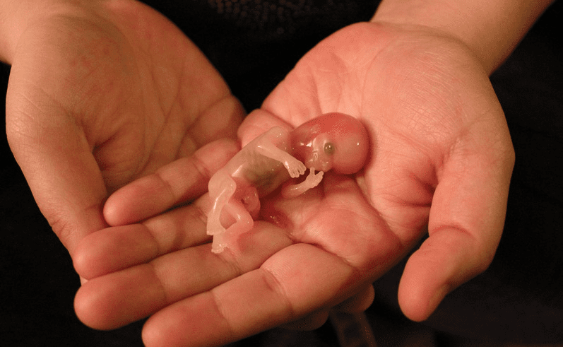 Abortion pills)  City/Qatar/Doha/ 966594258456 cytotec tablets uses abortion pills How effective is the abortion p